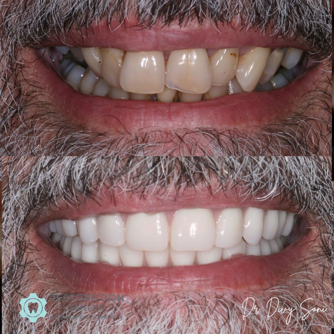 smile gallery smile gallery